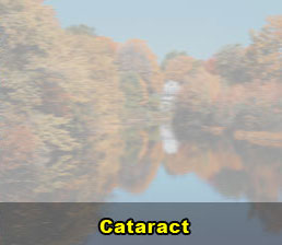 cataracts